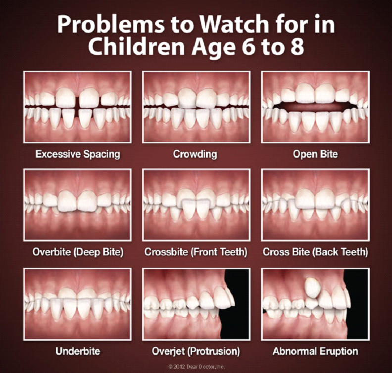 Dentist for Children in Battle - Different cases